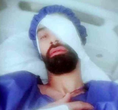 فوتبالیست ملی پوش ایرانی نابینا شد + عکس