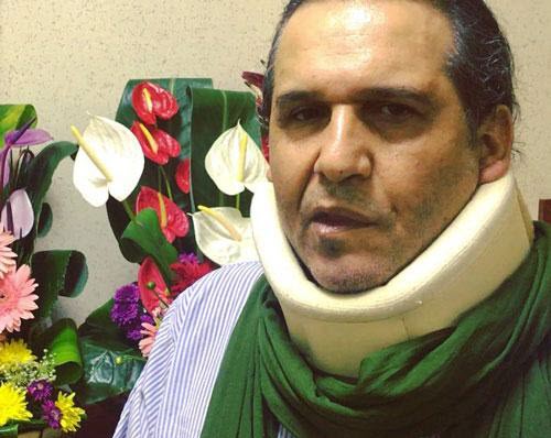 اولین صحبت&zwnj;های &laquo;عمو فردوس&raquo; پس از فلج شدن صورتش +فیلم