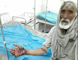 حمله گاندو به یک چوپان در جنوب سیستان وبلوچستان