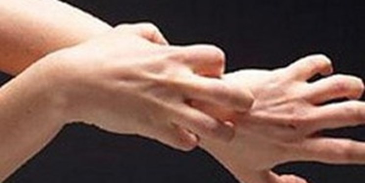 بیماری&raquo; کلستاز&raquo; در زنان چیست؟///صادقی