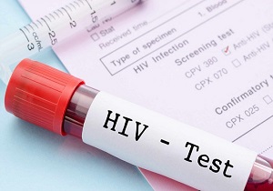 آخرین اخبار از لردگان/ معاون وزیر بهداشت: بر اساس پروتکل وزارت برای شناسایی مبتلایان به HIV اقدام می‌شود/ وضعیت تحت کنترل است