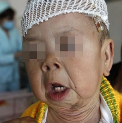 عجیب&zwnj;ترین کودکان دنیا/ از دختر پری دریایی تا پسری که سالی ۵ بار می&zwnj;میرد