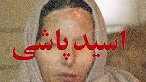 ایراد شورای نگهبان به طرح تشدید مجازات اسید پاشی رفع شد