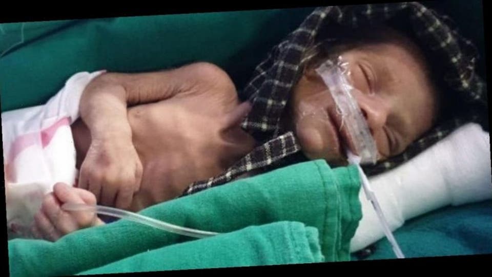زنده&zwnj;ماندن نوزاد دختر پس از ۲ روز تدفین در قبر + عکس