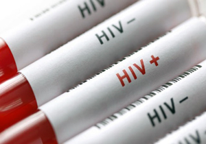 ۹۳ درصد مبتلایان به HIV در چنارمحمودی تحت درمان قرار گرفتند