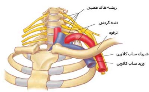زنگ خطر سندروم خروجی قفسه سینه با دنده گردنی به صدا در می&zwnj;آید