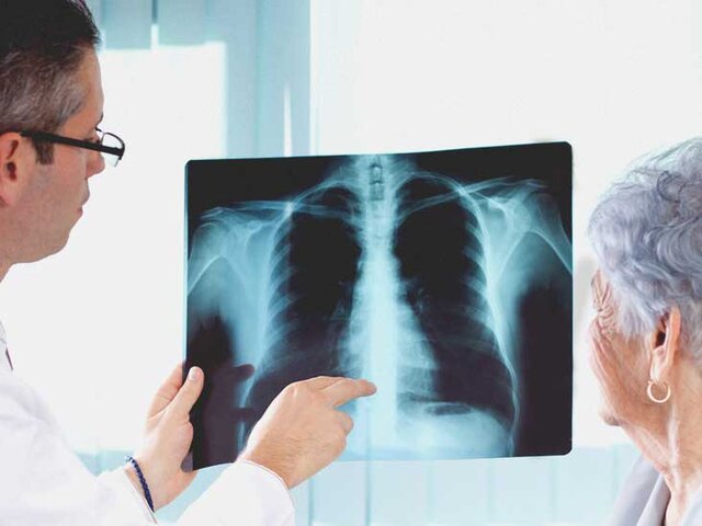 چرا عفونت&zwnj;های تنفسی در مبتلایان به دیابت کشنده&zwnj;ترند؟//تنها