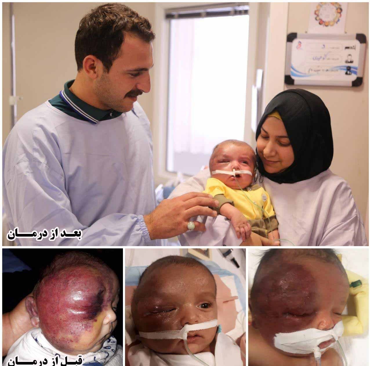 نجات جان کودک ۲ ماهه عراقی مبتلا به یک سندروم کشنده در بیمارستان رضوی مشهد+تصویر نجات جان کودک ۲ ماهه عراقی مبتلا به یک سندروم کشنده در بیمارستان رضوی مشهد+تصویر