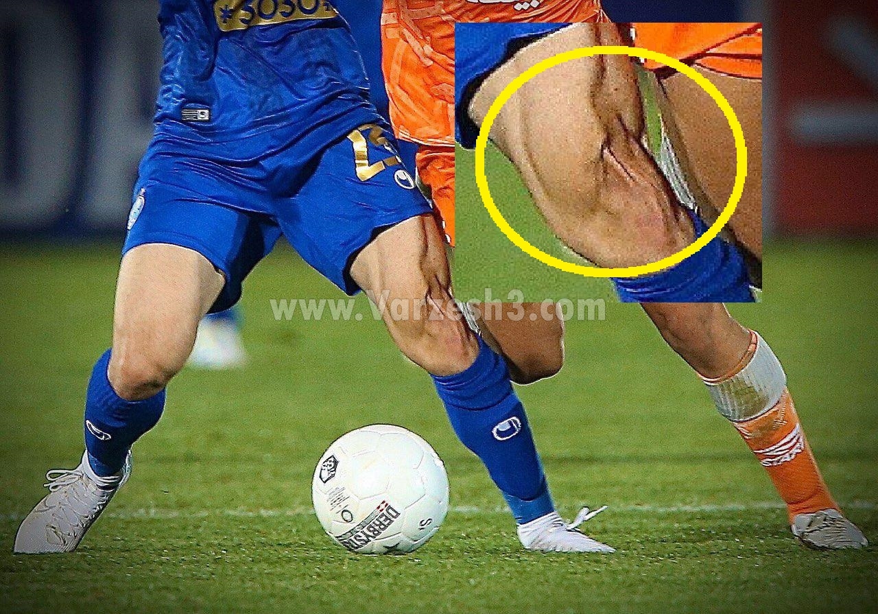 لحظه پارگی رباط صلیبی داریوش شجاعیان + عکس
