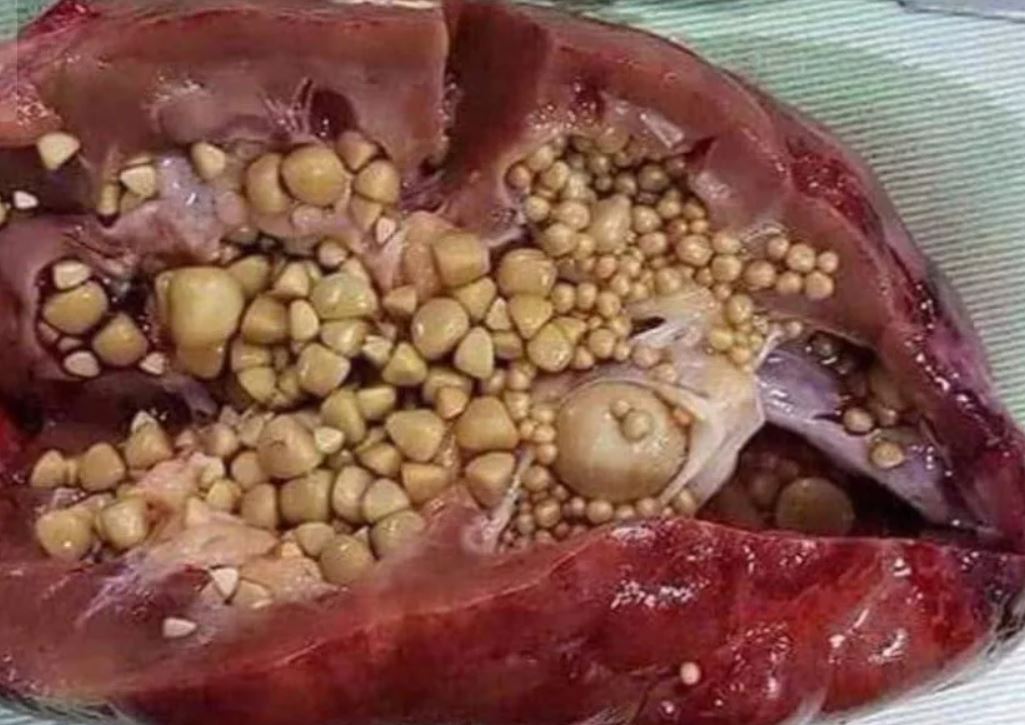 15 درمان مشکلات کلیوی با طب سنتی