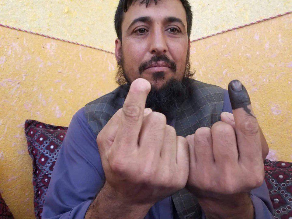 عکس: مردی که طالبان انگشتش را قطع کرده بود دوباره رای داد