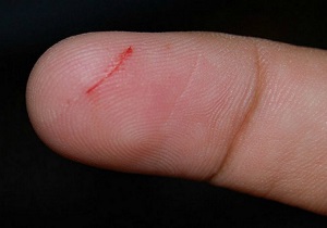 چگونه با ورزش زخم&zwnj;های خود را سریع&zwnj;تر ترمیم کنیم؟