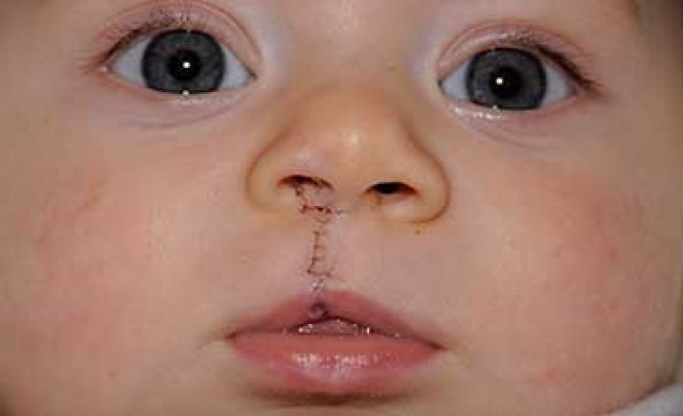 عارضه جزء لاینفک هر جراحی به شمار می&zwnj;رود