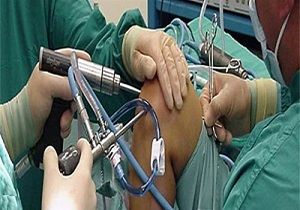 بررسی راهکارهای کاهش عوارض ناشی از تحریم‌ها در حوزه ارتوپدی