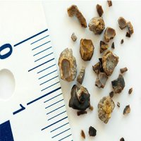 چند راهکار ساده برای دفع سریع 