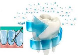 اجرای طرح وارنیش فلورایدتراپی دانش آموزان