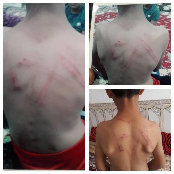 شلاق&zwnj;های بی رحمانه معلم ورزش بر بدن دانش آموز ۹ ساله! + عکس