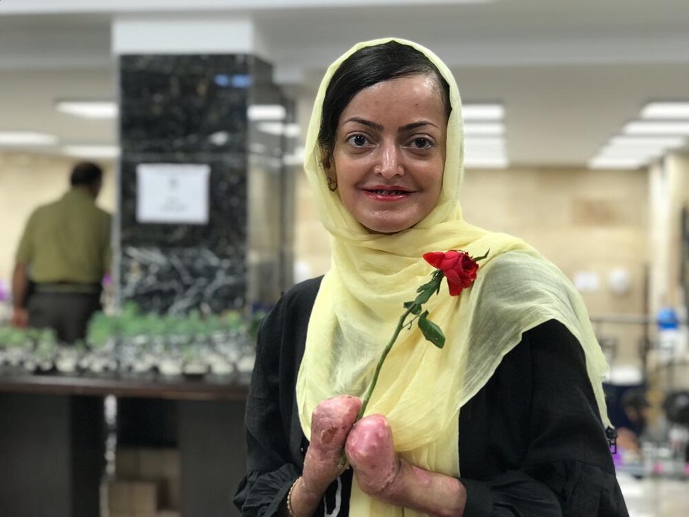 روایتی دردناک از پروانه&zwnj;هایی که در آتش تحریم می&zwnj;سوزند؟ +تصاویر