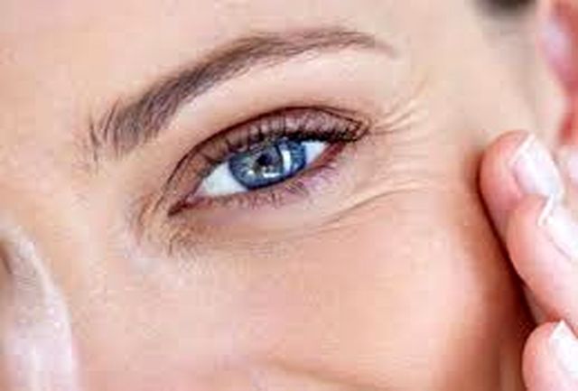 سه سوته چروک&zwnj;های زیر چشم را برطرف کنید