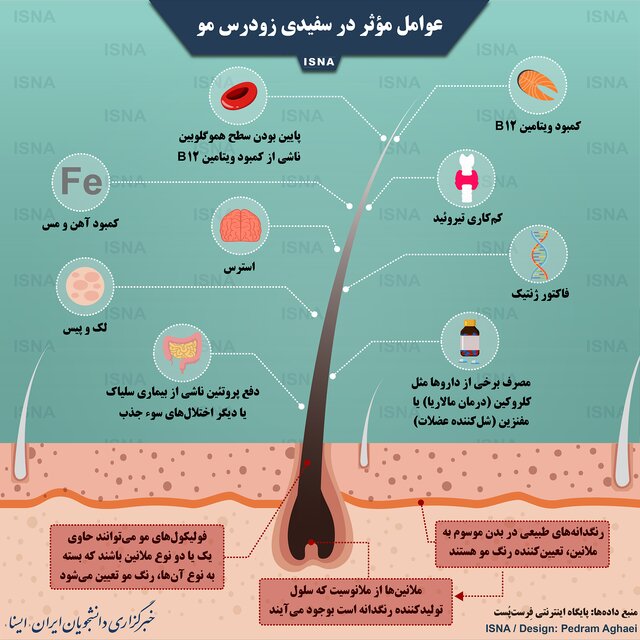عوامل مؤثر در سفیدی زودرس مو +اینفوگرافی عوامل مؤثر در سفیدی زودرس مو +اینفوگرافی