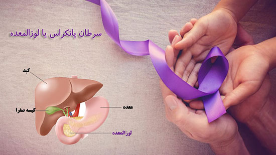 سرطان لوزالمعده و سوالات متداول دربار&zwnj;ه&zwnj;ی آن////////گلی