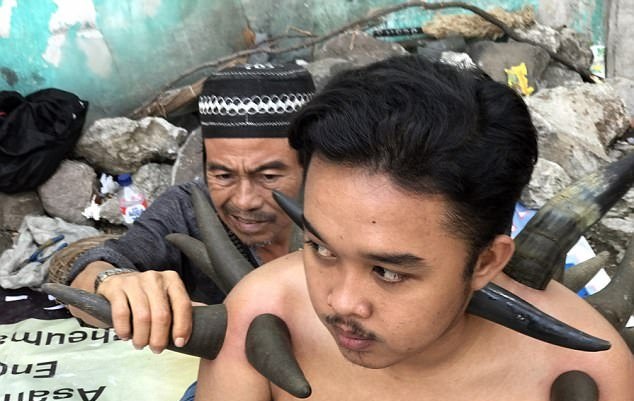 حجامت با شاخ گاو! + تصاویر