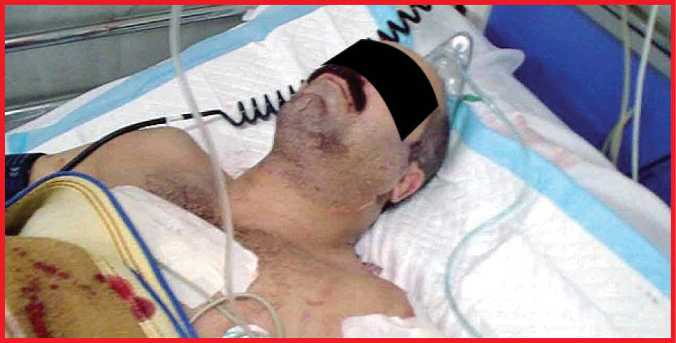 طناب&zwnj;دار در انتظار &laquo;گـرگ شهـر&raquo;