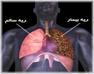 ۵ روش طبیعی برای سم زدایی از ریه افراد سیگاری