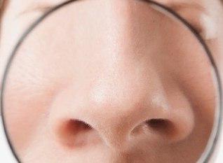 فرم&zwnj;دهی بینی بدون جراحی و هرآنچه باید بدانید