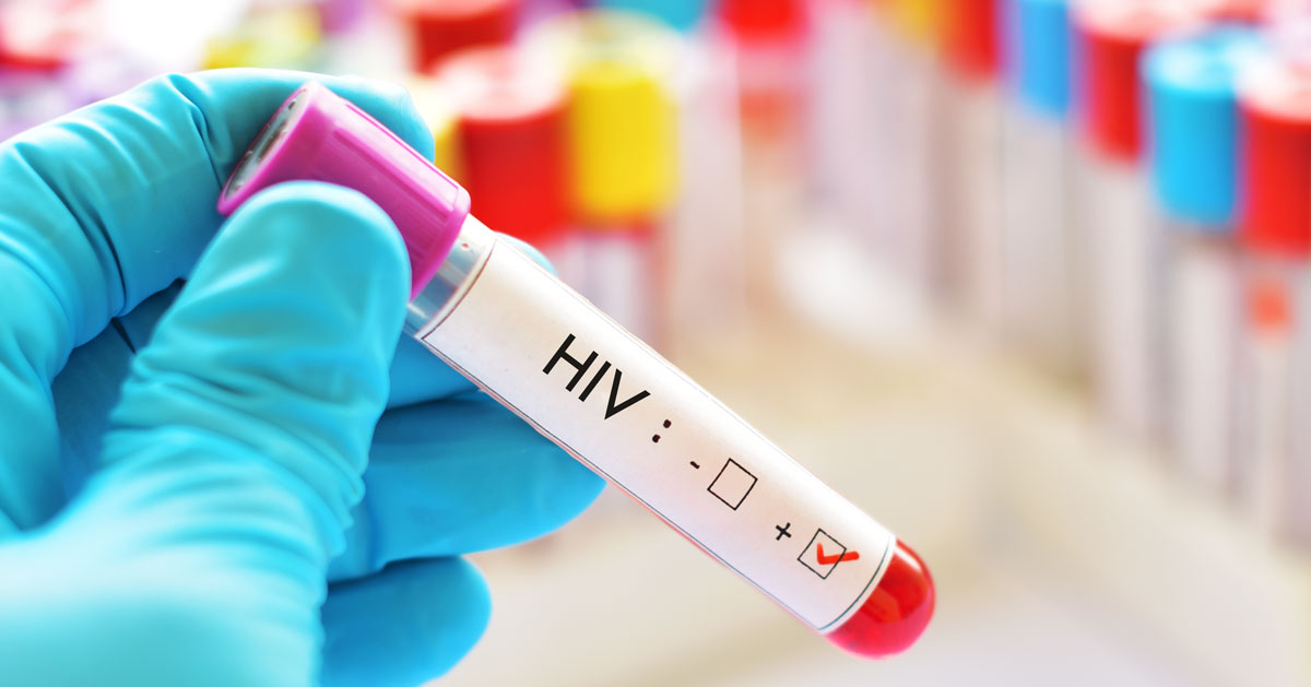 کاهش ۳۰ درصدی انتقال ویروس HIV در بین معتادان تزریقی