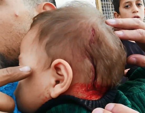 زخمی شدن نوزاد فلسطینی در حمله شهرک&zwnj;نشینان به الخلیل