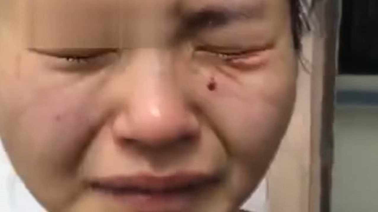 حمله بیمار نیجریه ای به پرستار چینی در قرنطینه!