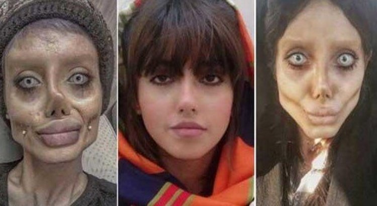 ابتلای سحر تبر به کرونا و بستری شدن در بیمارستان سینا