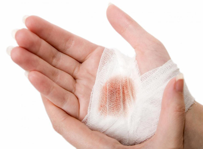بانداژ نانو، با قابلیت رصد وضعیت زخم از راه دور