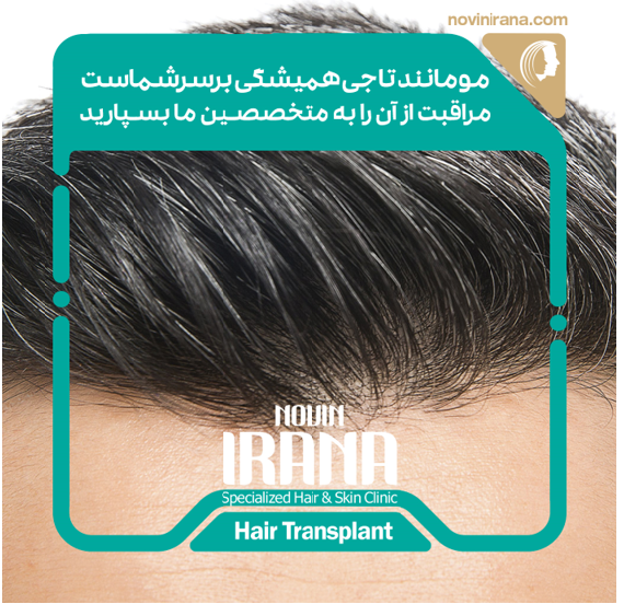 کاشت مو و جراحی لیپوساکشن با کلینیک نوین ایرانا
