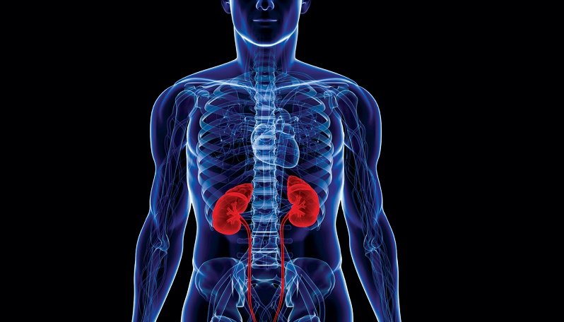 چگونه ار شر کلیه درد خلاص شویم؟