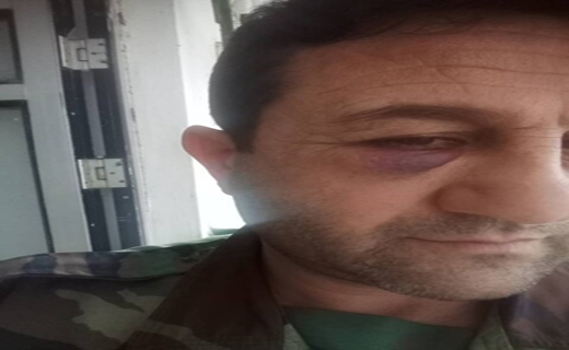 دستگیری قاچاقچیان متواری چوب آلات جنگلی تالش/ مصدومیت شدید ۲ جنگلبان دستگیری قاچاقچیان متواری چوب آلات جنگلی تالش/ مصدومیت شدید ۲ جنگلبان