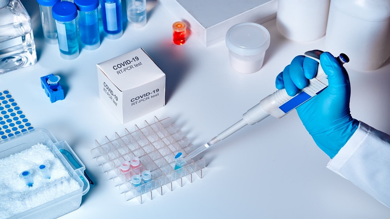 آمادگی دانش بنیان‌ها برای تولید کیت تشخیص سریع کرونا