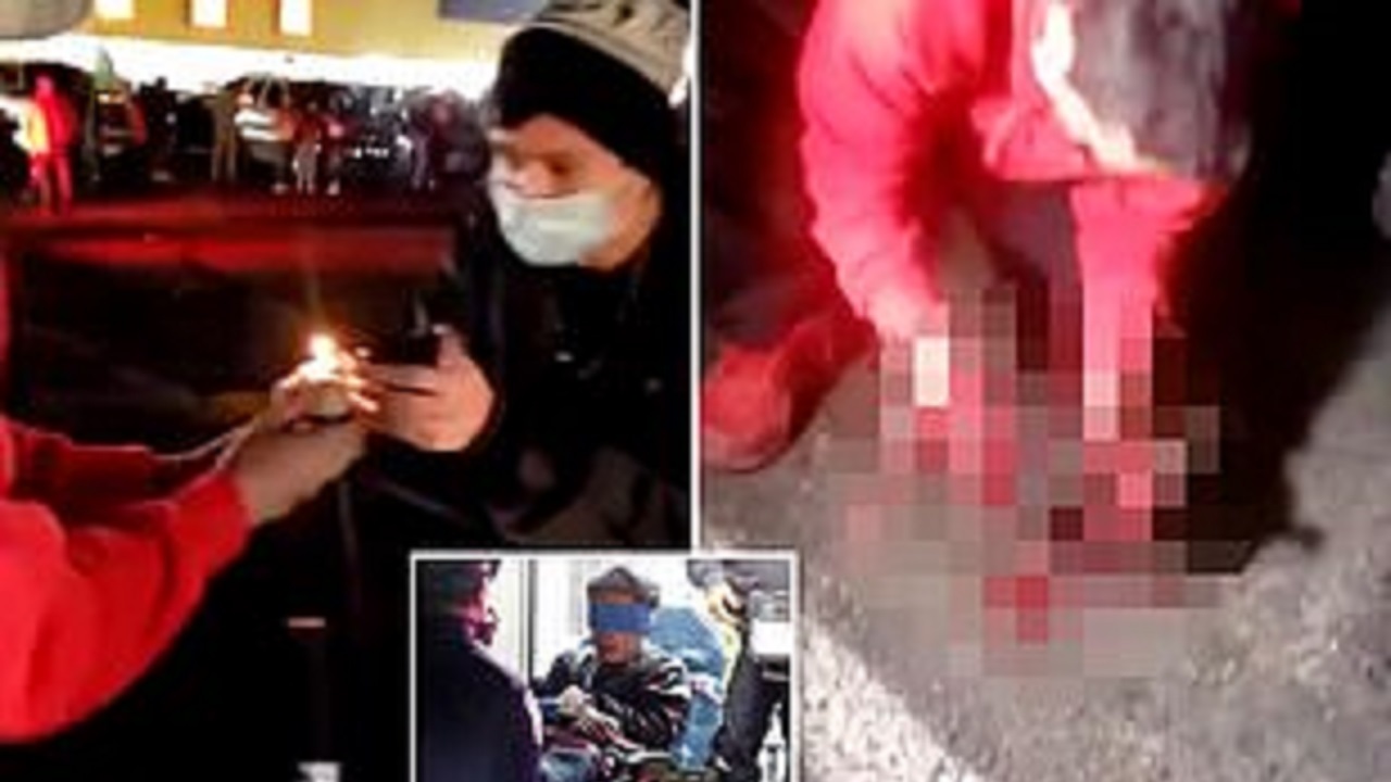 لحظه وحشتناک انفجار ترقه در دست  و صورت دو پسر جوان(18+)