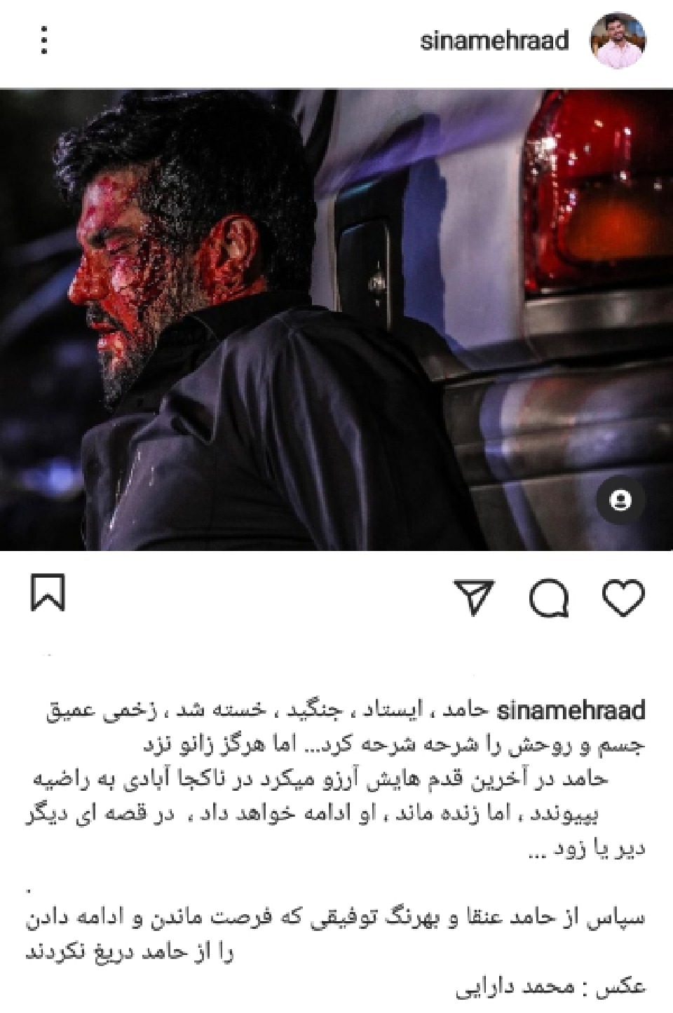 پست بازیگر آقازاده بعد از قسمت اخر