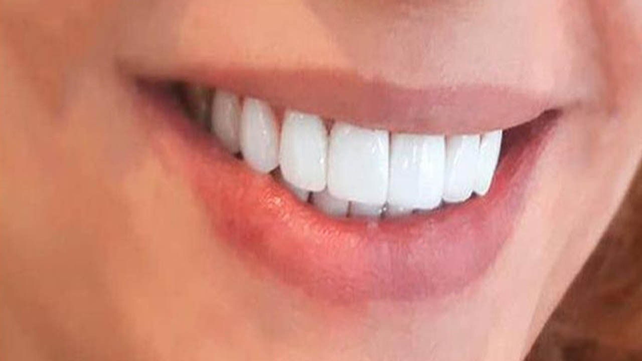 تاکید بر انجام اعمال دندانپزشکی ضروری