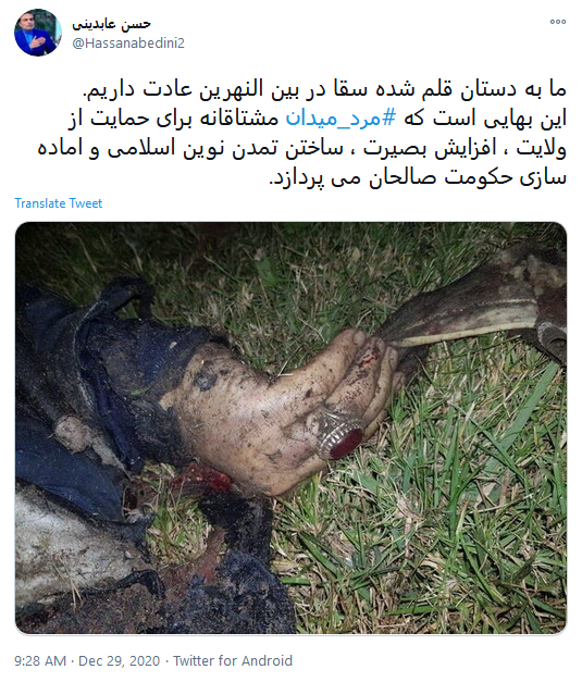 ما به دستان قلم شده سقا در بین النهرین عادت داریم