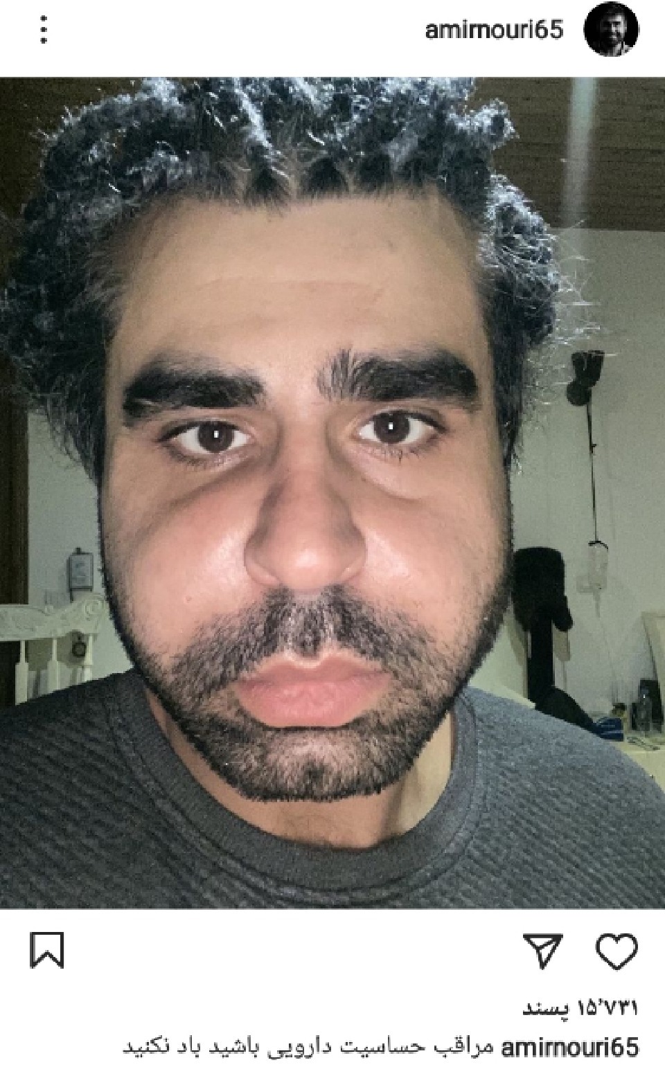 حساسیت امیر نوری پس از مصرف دارو