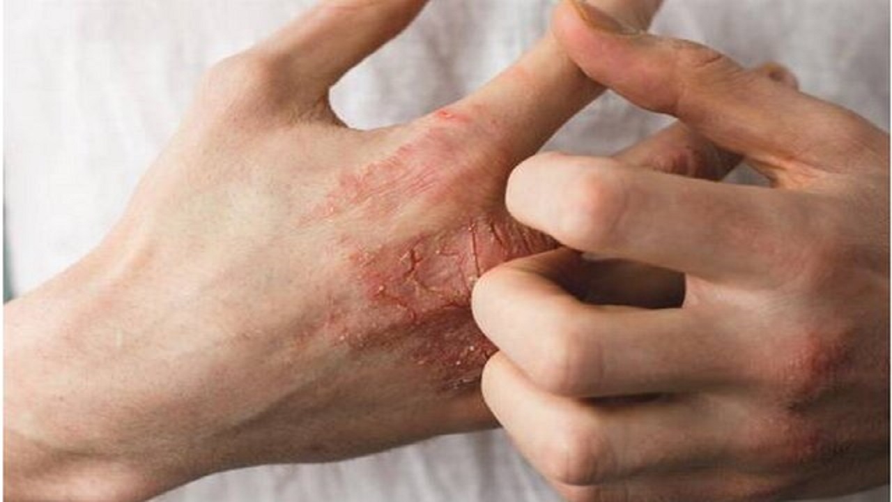 چند روش خانگی برای کاهش خشکی پوست