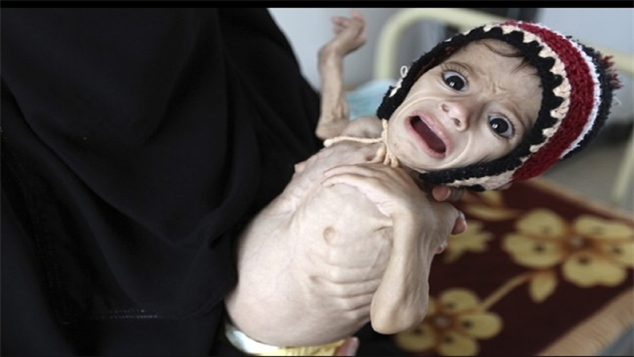 مقام سازمان ملل: یمن در آستانه فروپاشی است