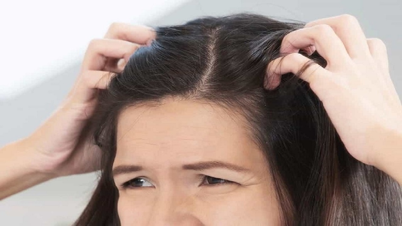 چرا به خارش سر مبتلا می شویم؟