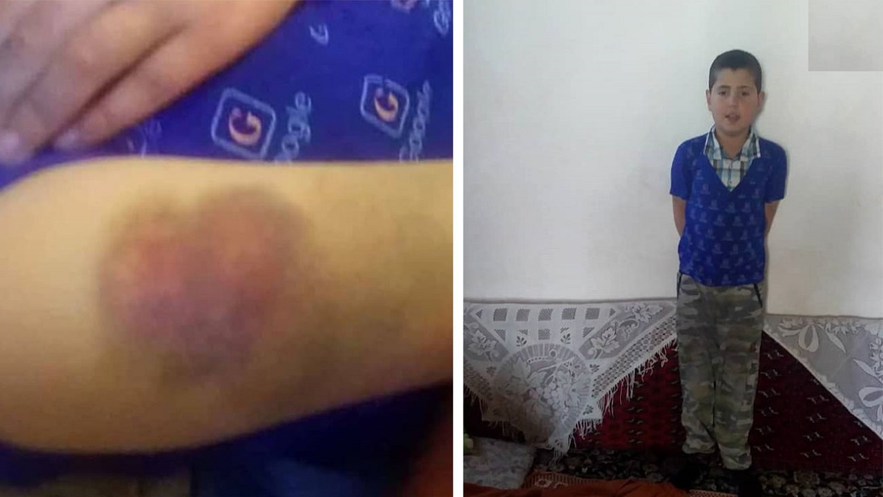 عذرخواهی معلم قزوینی به خاطر تنبیه شاگردش + فیلم