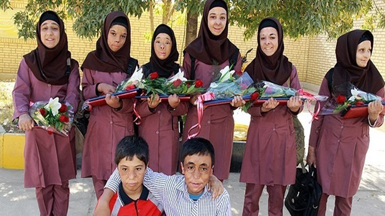 وعده استخدام به دانش آموزان سوخته درود زنی