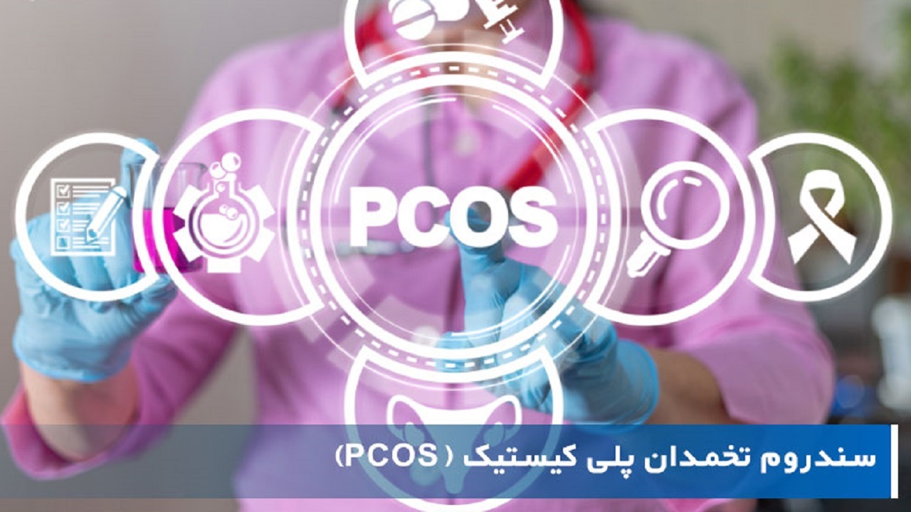علائم سندرم تخمدان پلی‌کیستیک باید از نوجوانی کنترل شود
