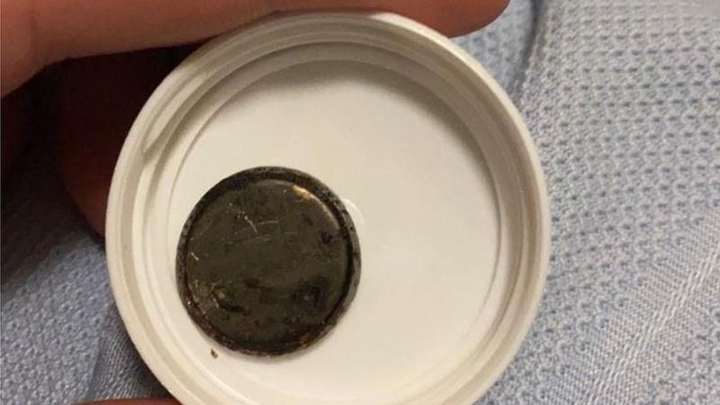 خطای پزشکی کودک را تا پای مرگ کشاند + تصاویر خطای پزشکی کودک را تا پای مرگ کشاند + تصاویر